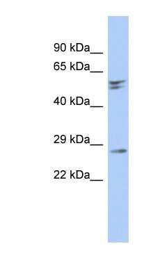 Western Blot: RD3 Antibody [NBP1-55461]