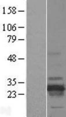 Western Blot: RD3 Overexpression Lysate [NBL1-15252]