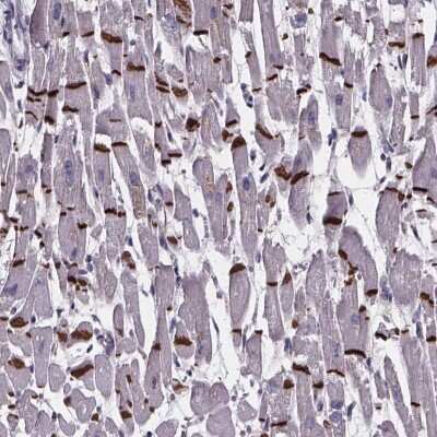 Immunohistochemistry: RD3L Antibody [NBP2-49539]