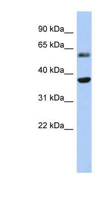 Western Blot: RDH10 Antibody [NBP1-62636]