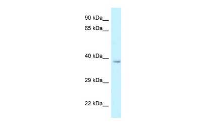 Western Blot: RDH10 Antibody [NBP2-85617]