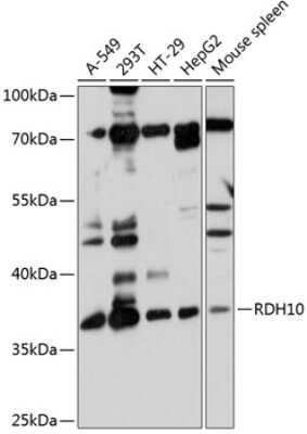 Western Blot: RDH10 AntibodyAzide and BSA Free [NBP2-93848]