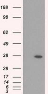 Western Blot: RDH11 Antibody (OTI1B4) [NBP2-02431]