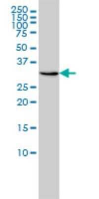 Western Blot: RDH11 Antibody (1H6) [H00051109-M01]