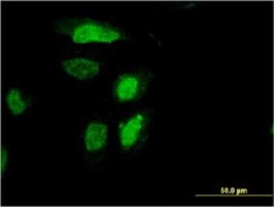 Immunocytochemistry/ Immunofluorescence: RDH12 Antibody (1E11) [H00145226-M01]