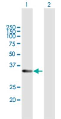 Western Blot: RDH12 Antibody [H00145226-B01P]