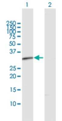 Western Blot: RDH12 Antibody [H00145226-D01P]