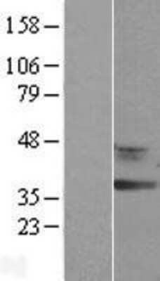 Western Blot: RDH12 Overexpression Lysate [NBL1-15256]