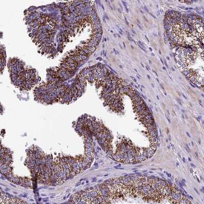 Immunohistochemistry-Paraffin: RDH13 Antibody [NBP1-92324]