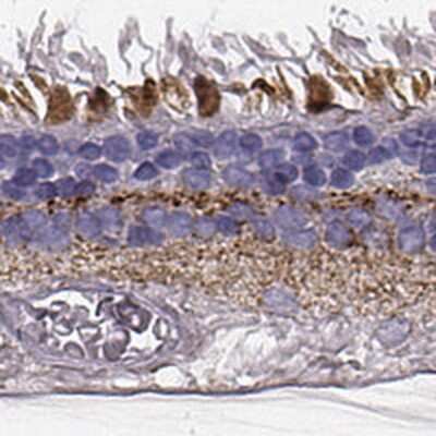 Immunohistochemistry-Paraffin: RDH13 Antibody [NBP1-92324]