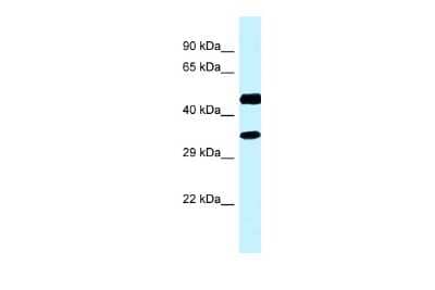 Western Blot: RDH13 Antibody [NBP2-85618]