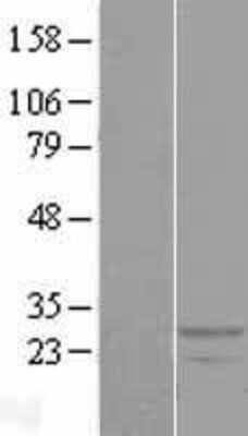 Western Blot: RDH13 Overexpression Lysate [NBP2-05670]