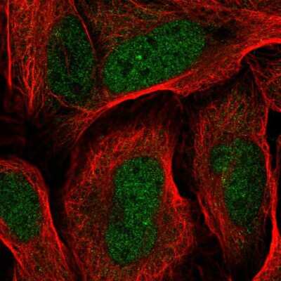Immunocytochemistry/ Immunofluorescence: RDH14 Antibody [NBP2-31647]