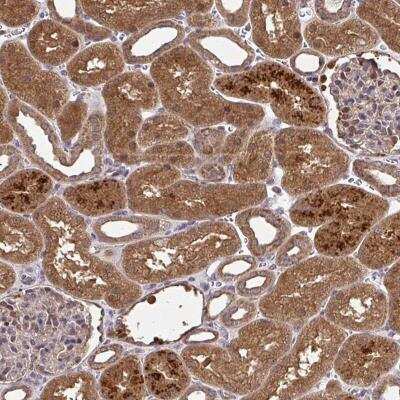 Immunohistochemistry-Paraffin: RDH14 Antibody [NBP2-31647]
