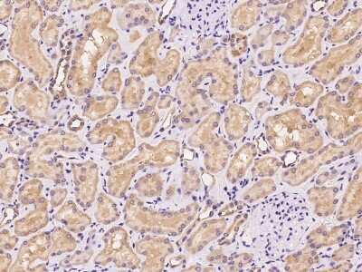 Immunohistochemistry-Paraffin: RDH14 Antibody [NBP3-06302]