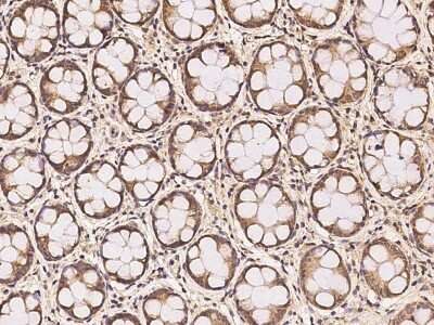 Immunohistochemistry-Paraffin: RDH14 Antibody [NBP3-06302]