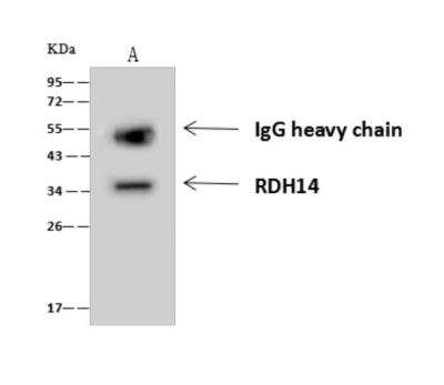 Immunoprecipitation: RDH14 Antibody [NBP3-06302]