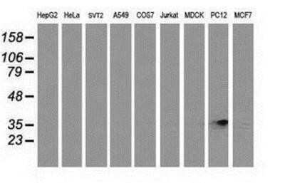 Western Blot: RDH14 Antibody (OTI1A7)Azide and BSA Free [NBP2-73847]