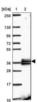 Western Blot: RDH14 Antibody [NBP2-31647]