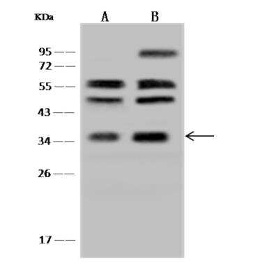 Western Blot: RDH14 Antibody [NBP3-06302]