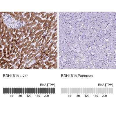 Immunohistochemistry-Paraffin: RDH16 Antibody [NBP1-87117]