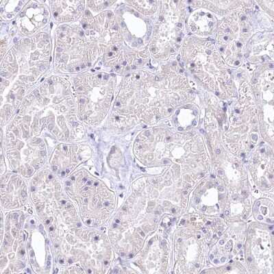 Immunohistochemistry-Paraffin: RDH16 Antibody [NBP1-87117]