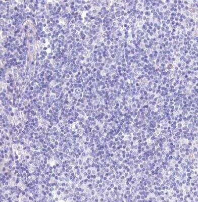 Immunohistochemistry-Paraffin: RDH16 Antibody [NBP1-87117]