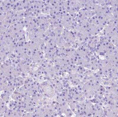 Immunohistochemistry-Paraffin: RDH16 Antibody [NBP1-87117]
