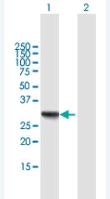 Western Blot: RDH16 Antibody [H00008608-B01P-50ug]