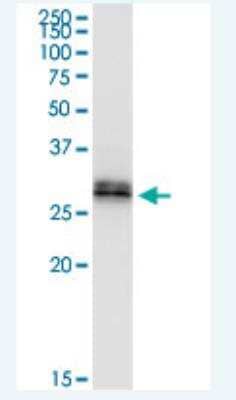 Western Blot: RDH16 Antibody [H00008608-B01P-50ug]