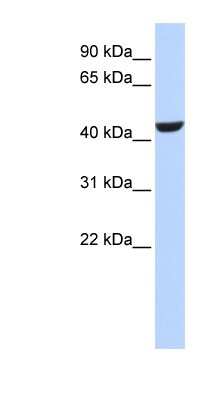 Western Blot: RDH16 Antibody [NBP1-58060]