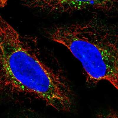 Immunocytochemistry/ Immunofluorescence: RDH5 Antibody [NBP2-56636]