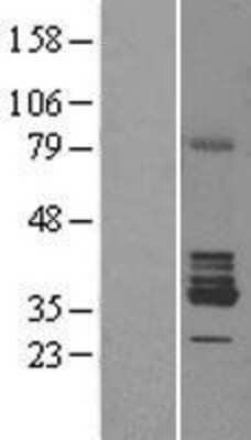 Western Blot: RDH5 Overexpression Lysate [NBL1-15259]