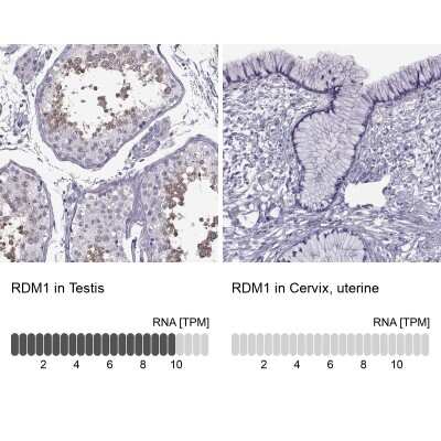 Immunohistochemistry-Paraffin: RDM1 Antibody [NBP2-62656]