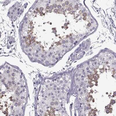 Immunohistochemistry-Paraffin: RDM1 Antibody [NBP2-62656]