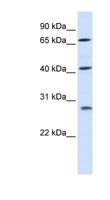 Western Blot: RDM1 Antibody [NBP1-53147]