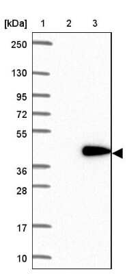 Western Blot: RDM1 Antibody [NBP1-82708]