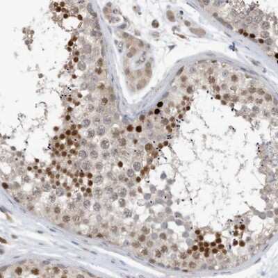 Immunohistochemistry-Paraffin: REC8 Antibody [NBP1-87144]