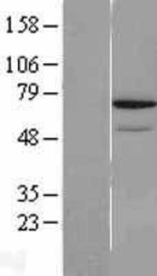 Western Blot: REC8 Overexpression Lysate [NBL1-15262]