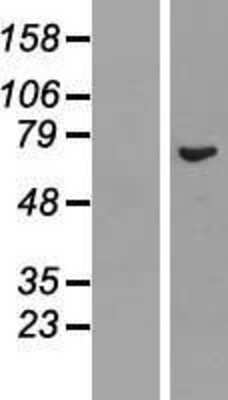 Western Blot: REC8 Overexpression Lysate [NBL1-15263]