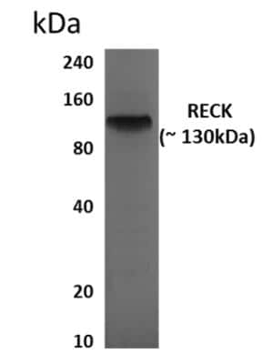 Western Blot: RECK Antibody (MM0523-9G19)Azide and BSA Free [NBP2-11863]