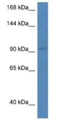 Western Blot: RECK Antibody [NBP1-79740]