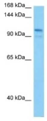 Western Blot: RECK Antibody [NBP3-10279]