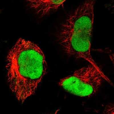 Immunocytochemistry/ Immunofluorescence: RECQ1 Antibody [NBP1-87803]