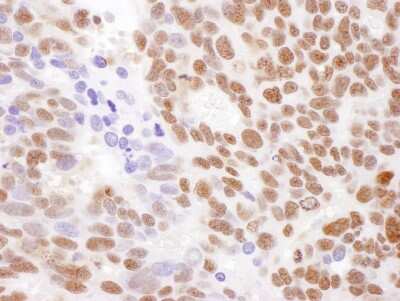Immunohistochemistry: RECQ1 Antibody [NB100-619]