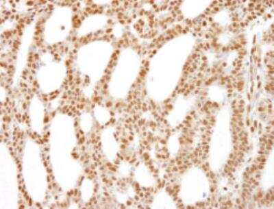 Immunohistochemistry-Paraffin: RECQ1 Antibody [NB100-618]