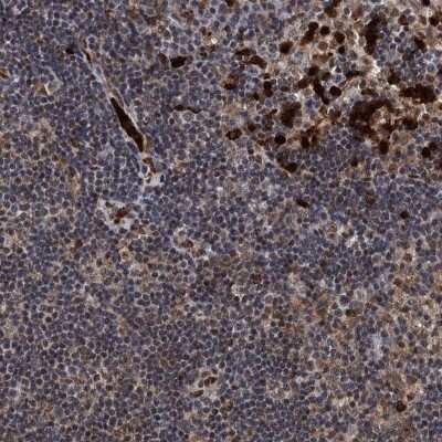 Immunohistochemistry-Paraffin: RECQ1 Antibody [NBP1-87803]