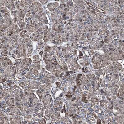 Immunohistochemistry-Paraffin: RECQ1 Antibody [NBP1-87803]