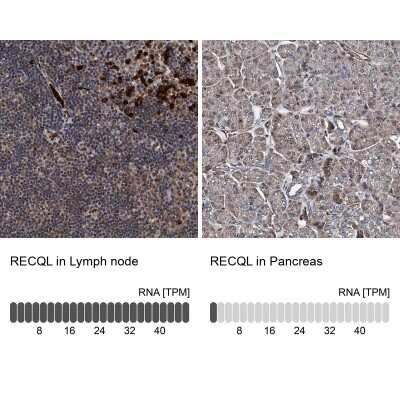 Immunohistochemistry-Paraffin: RECQ1 Antibody [NBP1-87803]