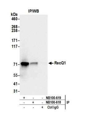 Immunoprecipitation: RECQ1 Antibody [NB100-619]